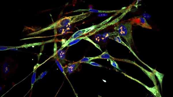 Επιστήμονες μετέτρεψαν καρκινικά κύτταρα σε υγιή μυϊκό ιστό χρησιμοποιώντας την τεχνολογία γονιδιακής επεξεργασίας CRISPR