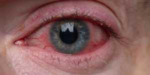 Συμπτώματα κορονοϊού: Ποια προβλήματα προκαλεί στην όραση και την ακοή