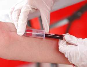 Έρευνα: Ποια ομάδα αίματος «προτιμάει» η Covid-19