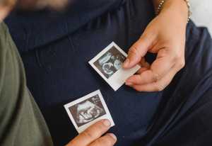 Ένθετο Υγεία: Εξωσωματική γονιμοποίηση με χαμηλό κόστος στο «Αρεταίειο»